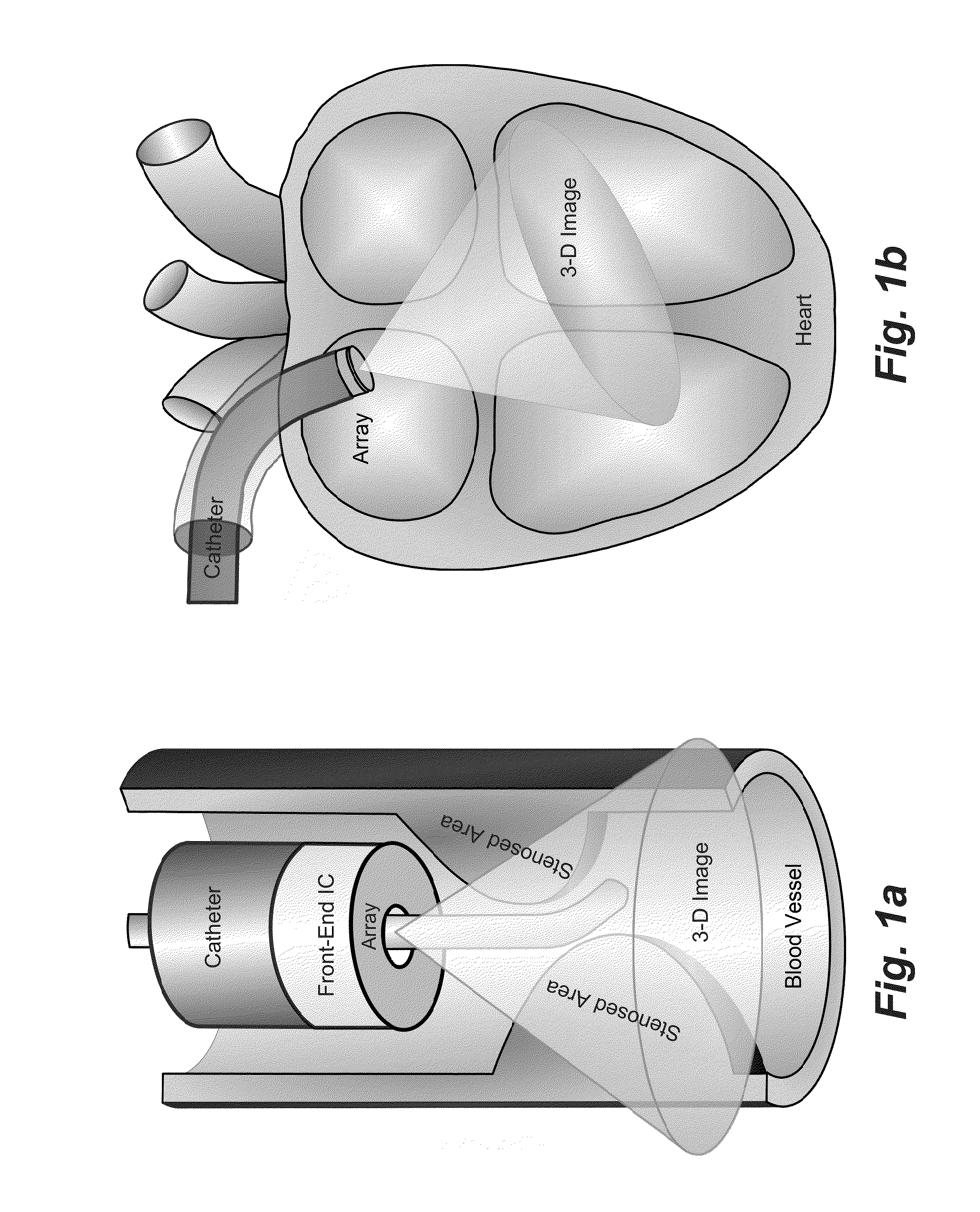 Compact, energy-efficient ultrasound imaging probes using cmut arrays with integrated electronics