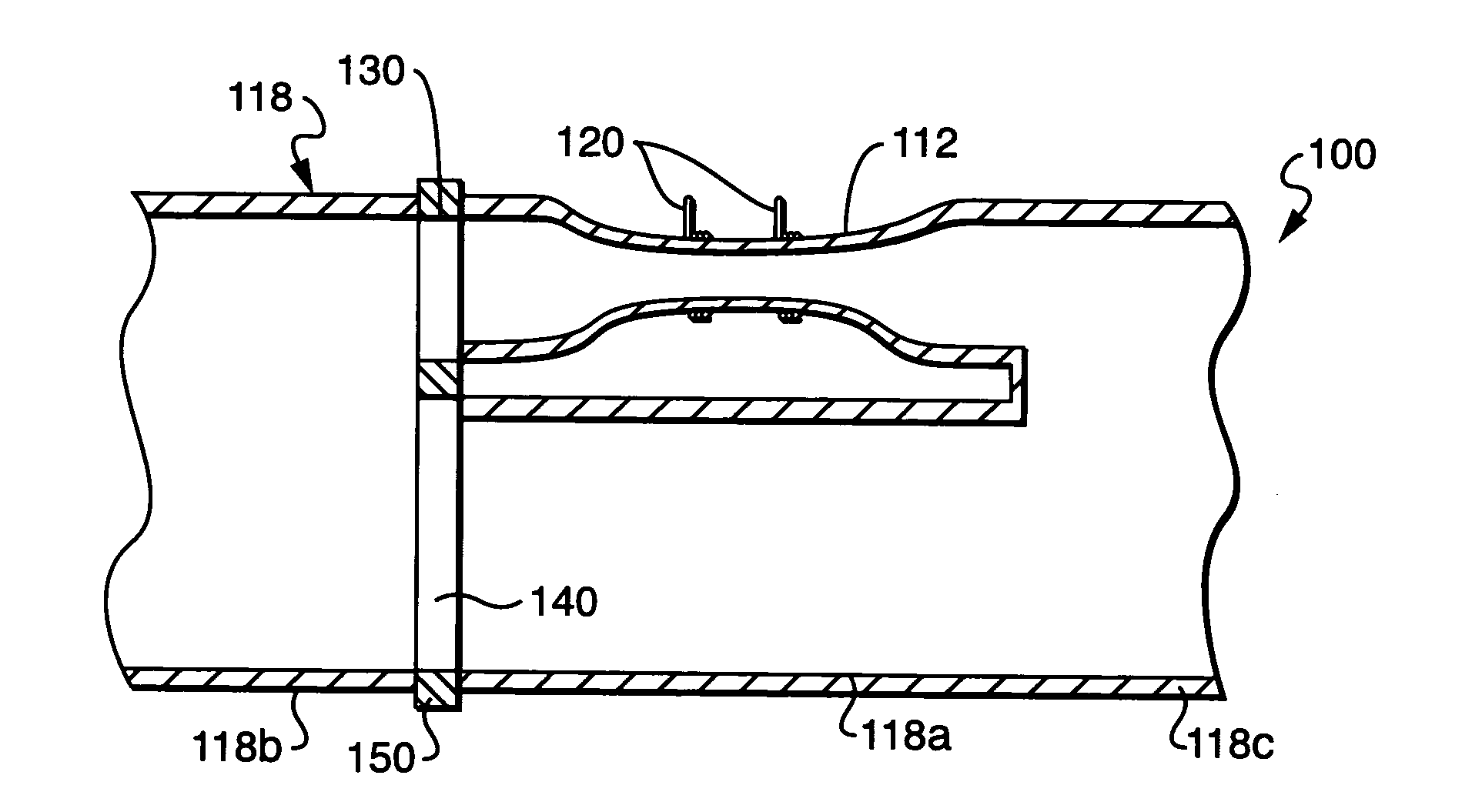 Thermal mass flow rate sensor having fixed bypass ratio