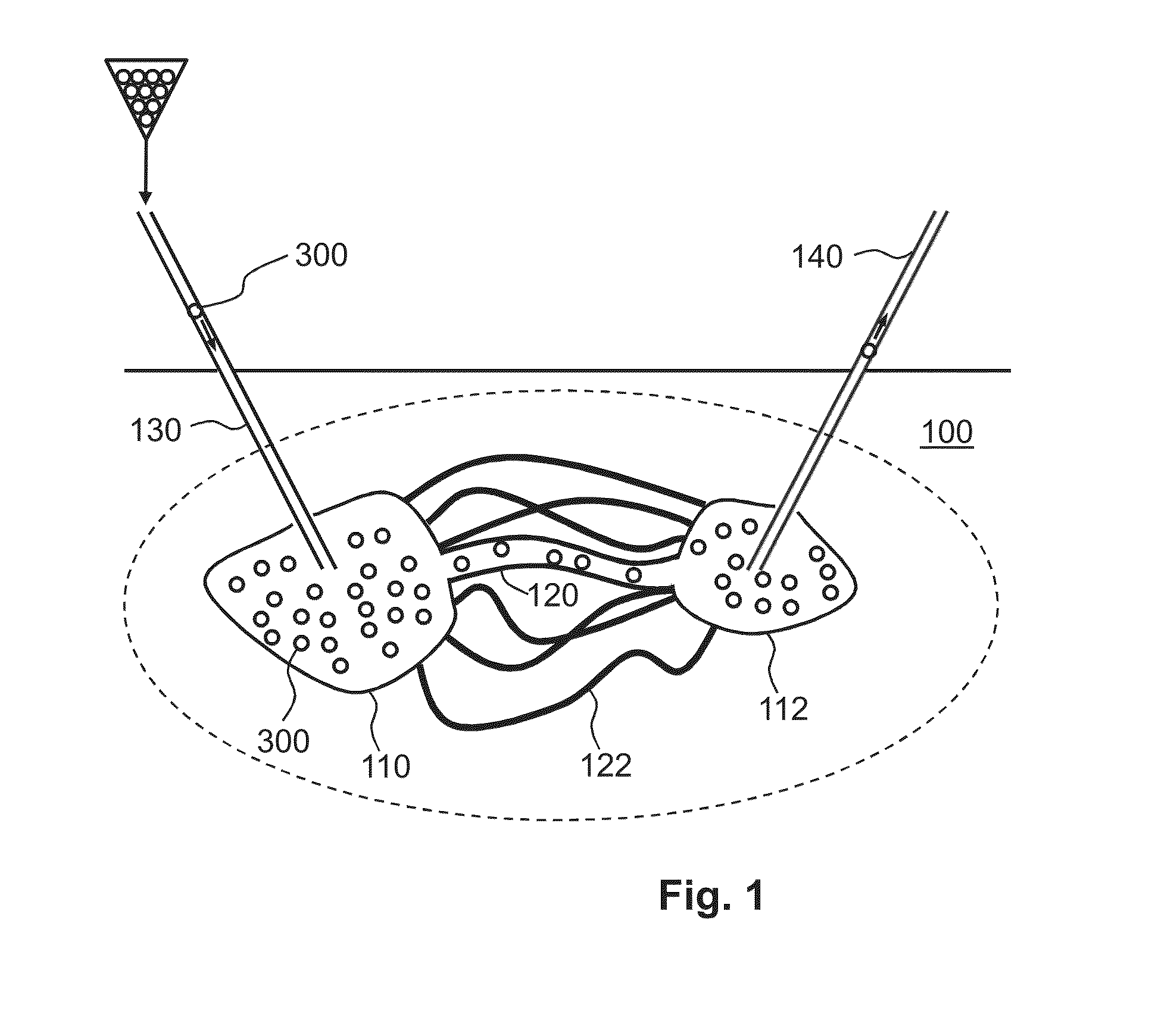 Sensor system, mote and a motes-system for sensing an environmental parameter