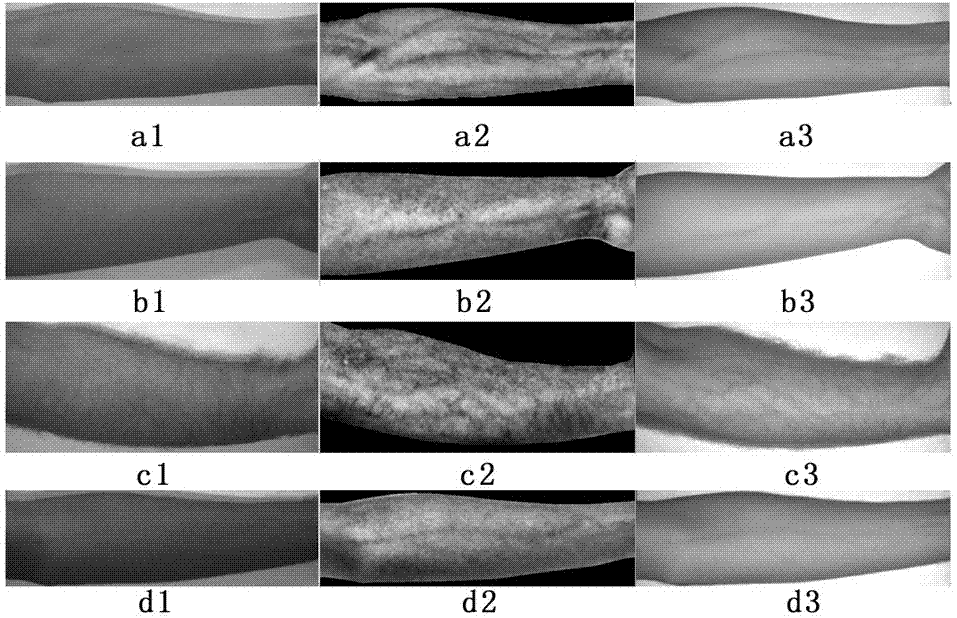 Visible light skin image vein imaging method