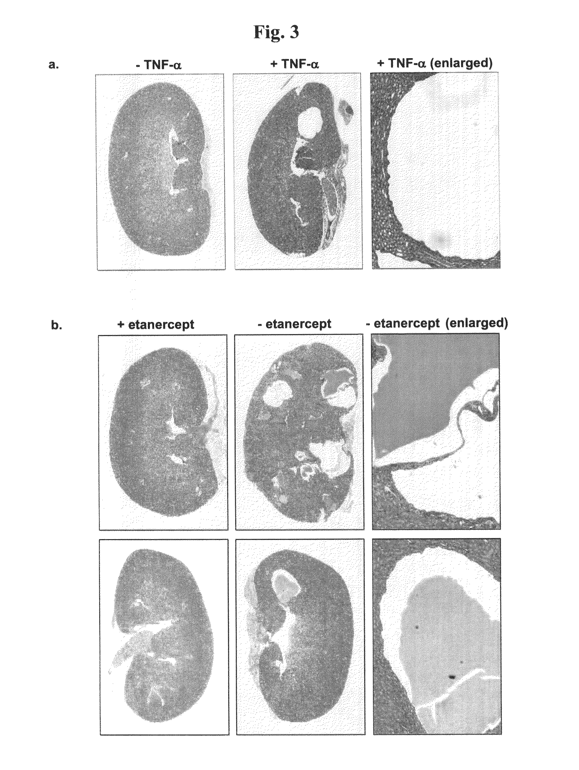 Methods for treating polycystic kidney disease (PKD) or other cyst forming diseases