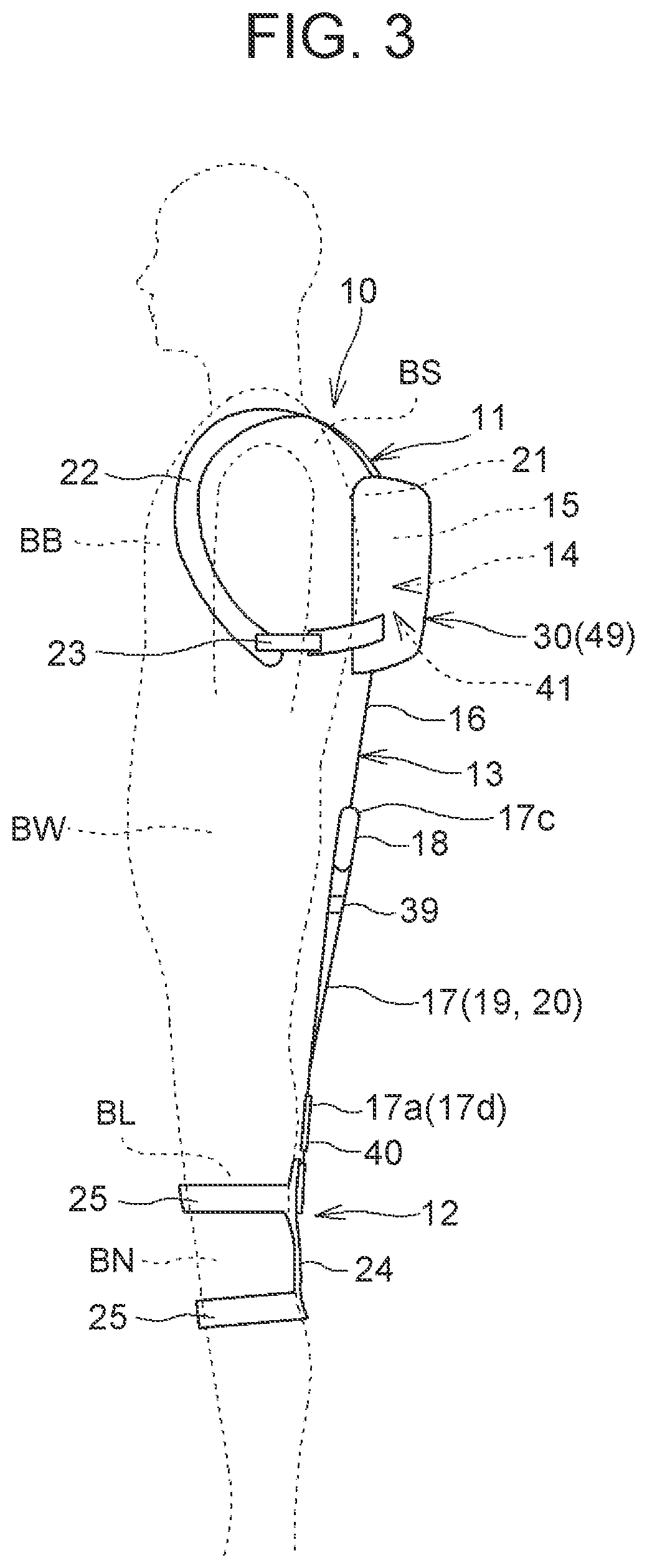 Assist device