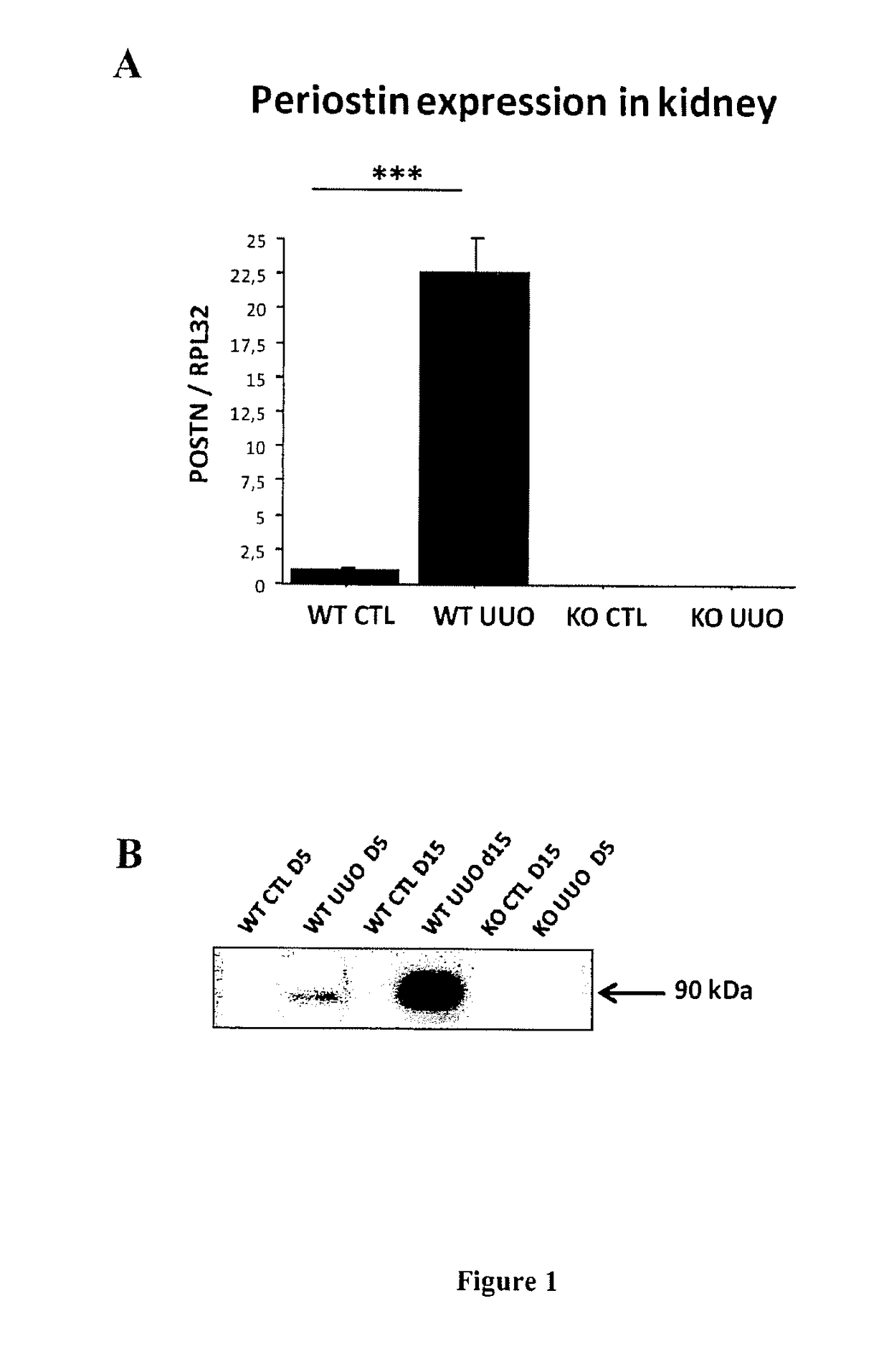 Methods for preventing and treating chronic kidney disease (CKD)