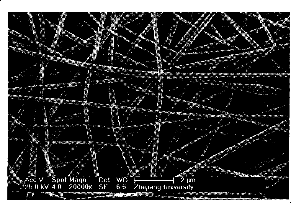 Preparation method of immobilized lipase used for grease hydrolysis