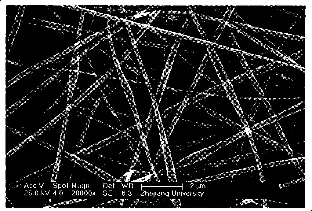 Preparation method of immobilized lipase used for grease hydrolysis