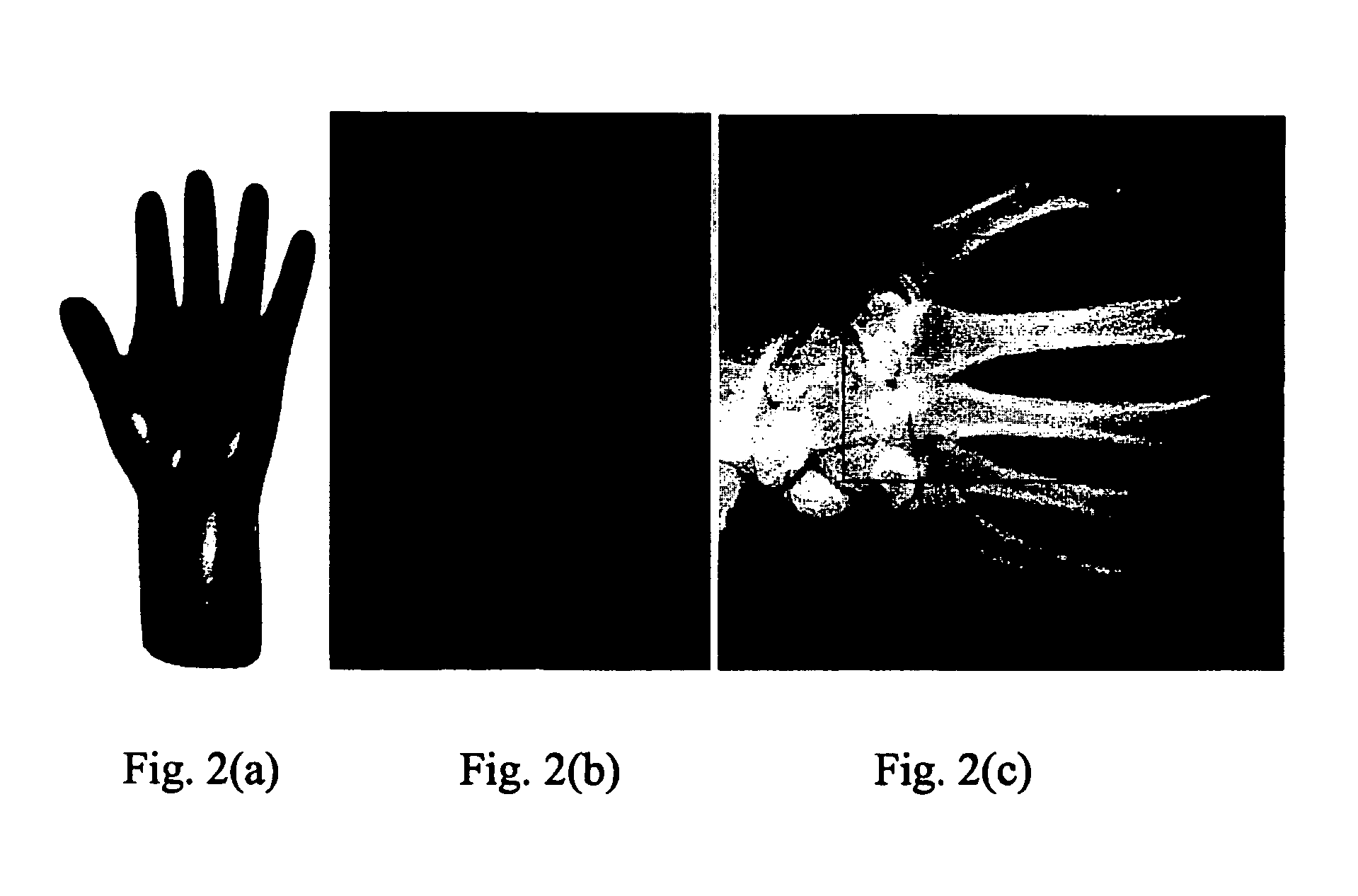 De-noising digital radiological images