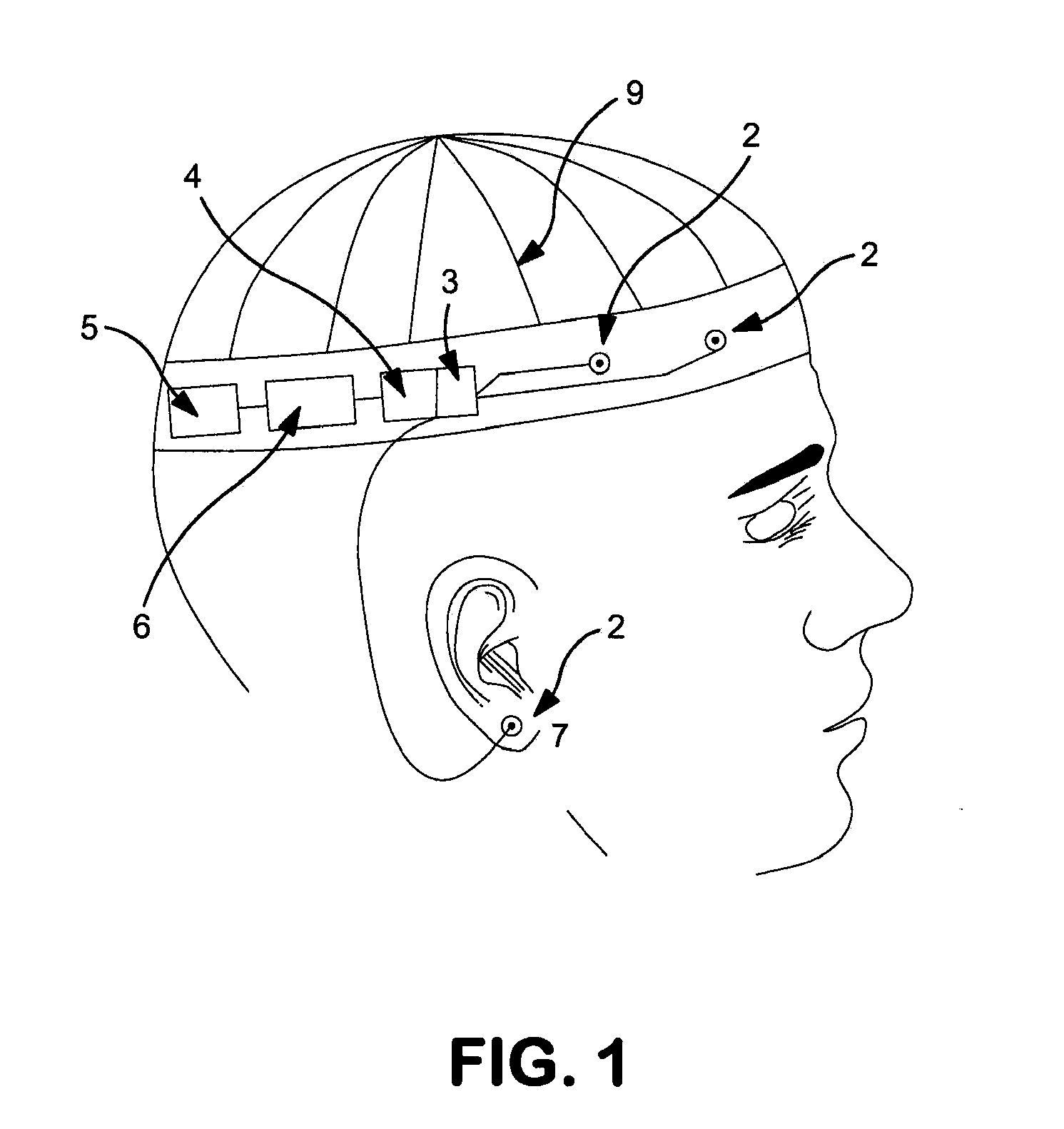 Remote continuous seizure monitor and alarm