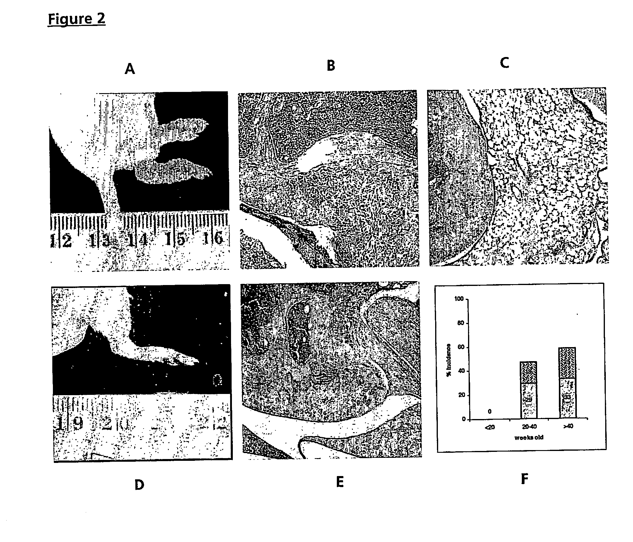 Fcyriia transgenic animal model for autoimmune disease