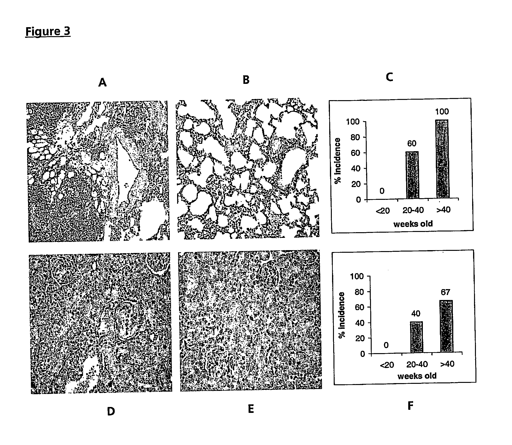 Fcyriia transgenic animal model for autoimmune disease