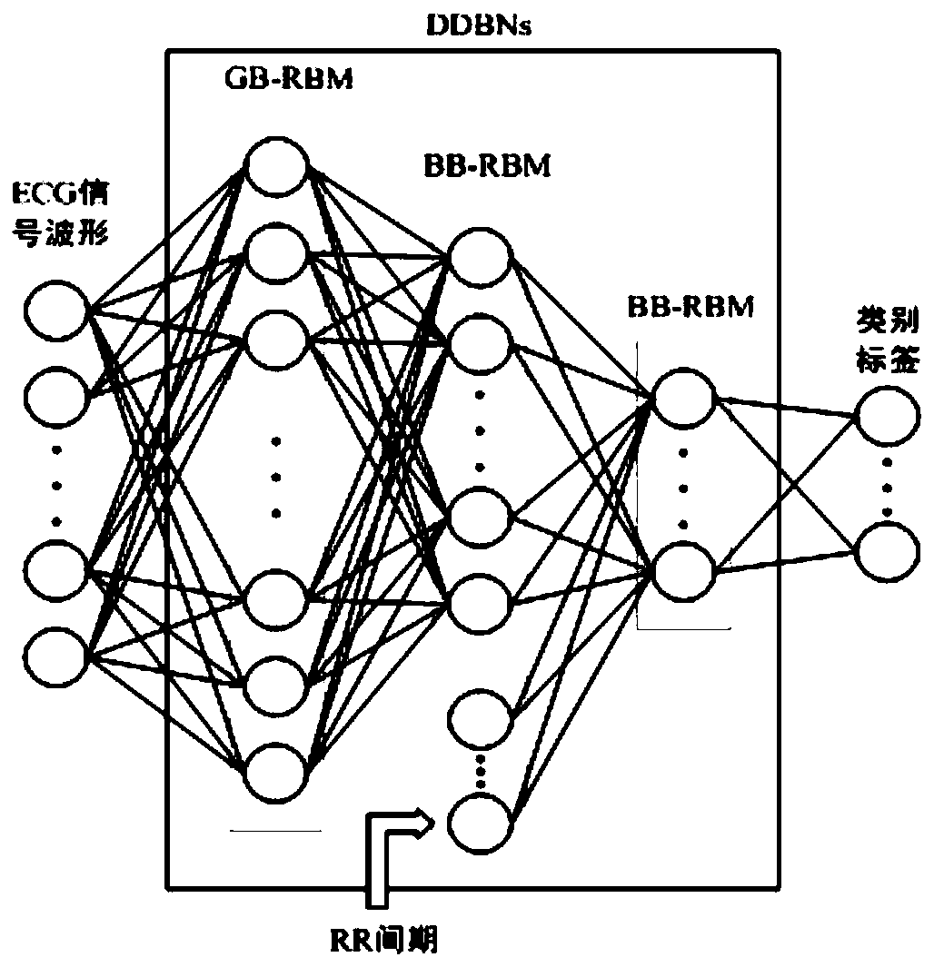 Automatic arrhythmia classifying method based on discriminant deep belief network