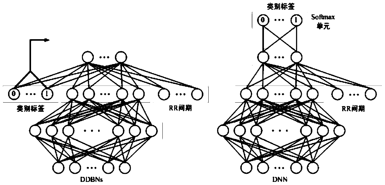 Automatic arrhythmia classifying method based on discriminant deep belief network