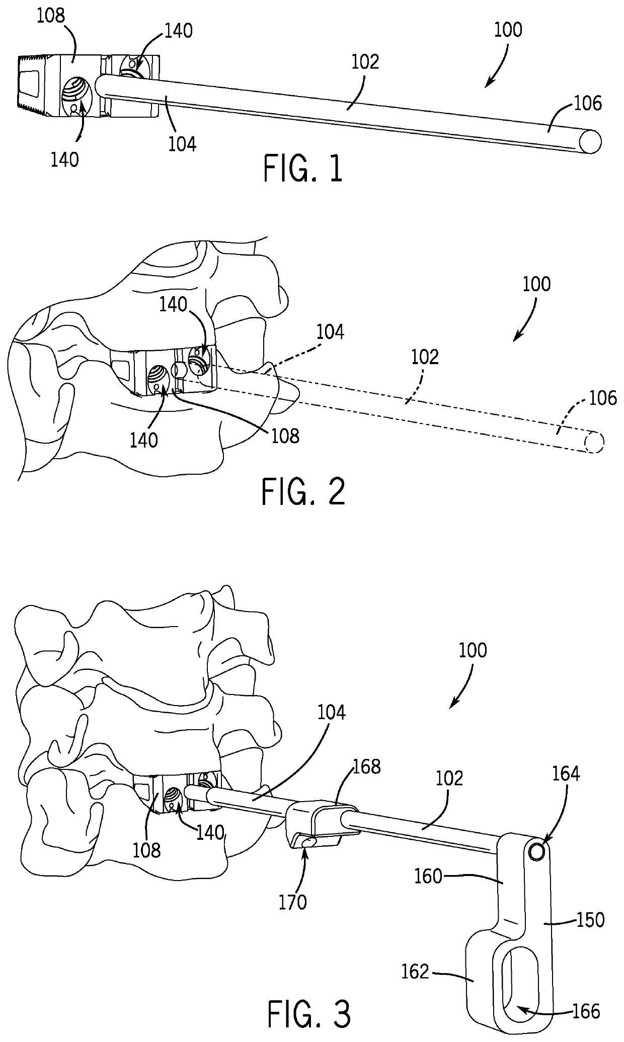 Spinal joint implant delivery device and system