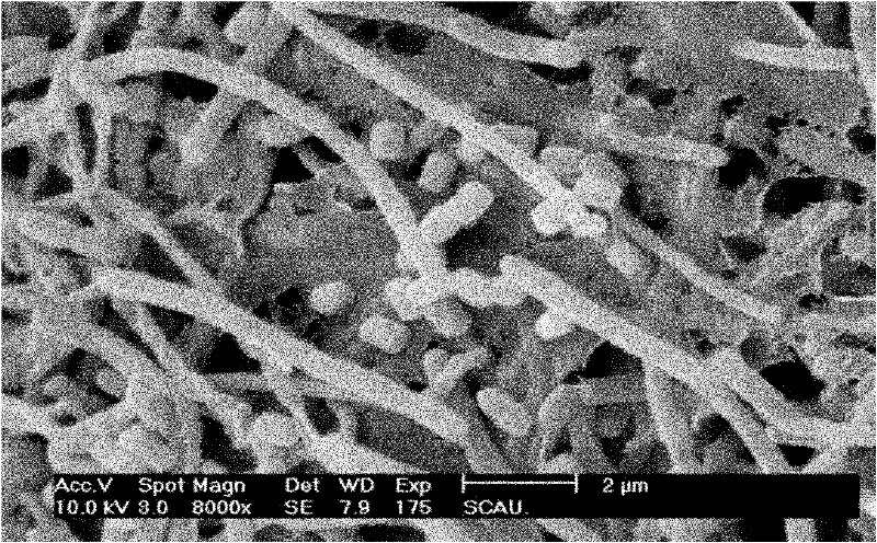 Streptomyces antibioticu and biological preparation prepared from active product thereof and application