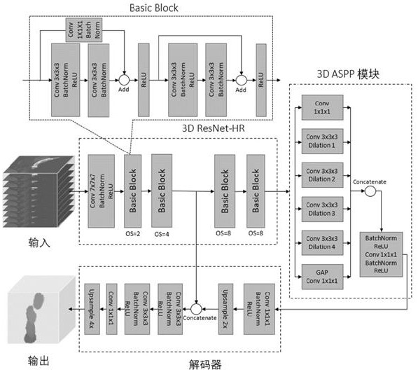 Rib fracture detection model training system and method, rib fracture detection system and method