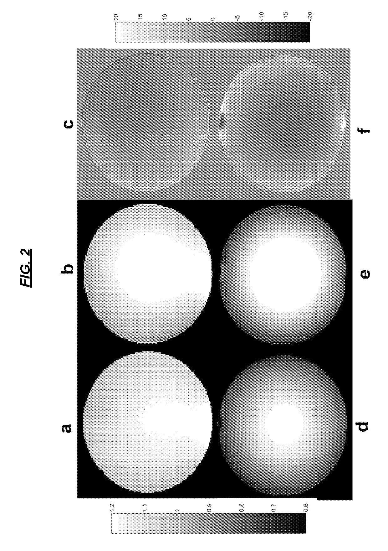 Signal inhomogeneity correction and performance evaluation apparatus