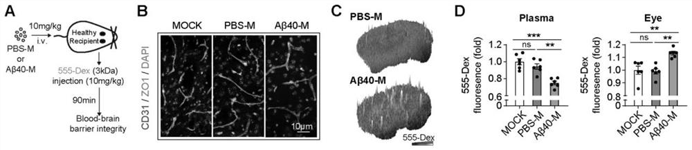 Application of macrophage migration body as cerebral amyloid vascular disease treatment target