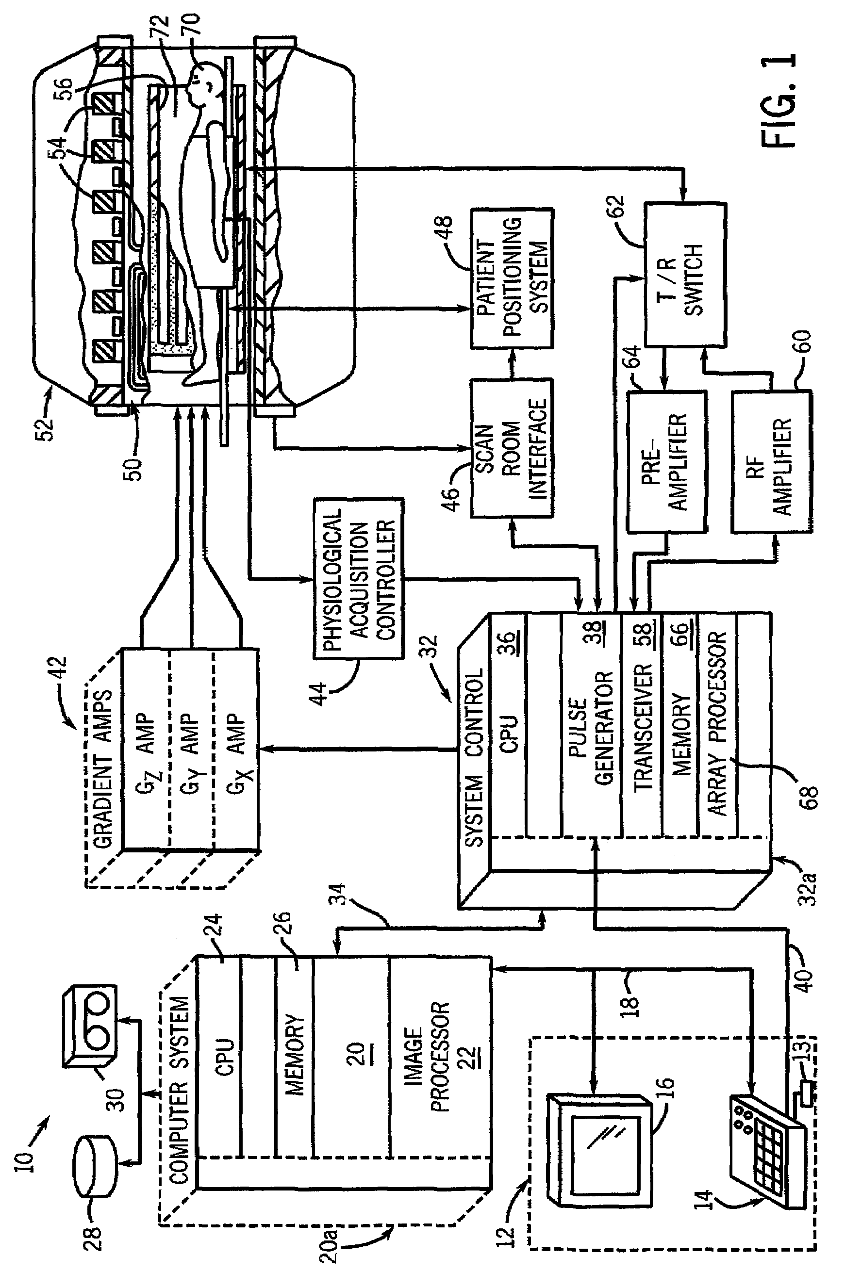 Method and apparatus for acquiring magnetic resonance imaging data