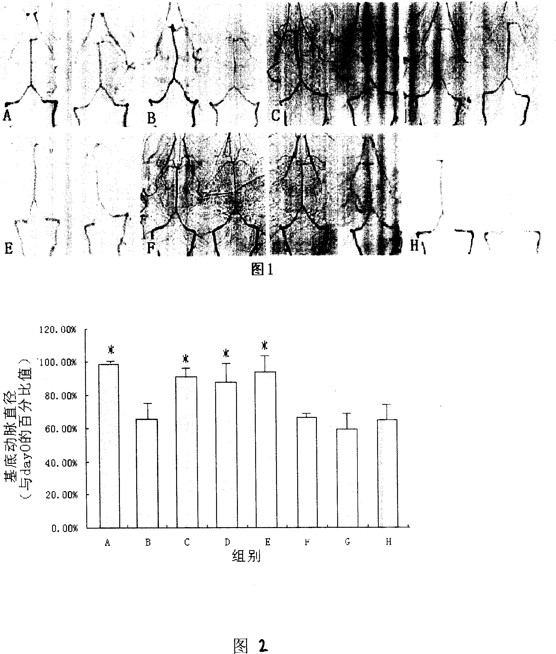 Application of carbenoxolone in preparation of medicine for treating cerebral vasospasm