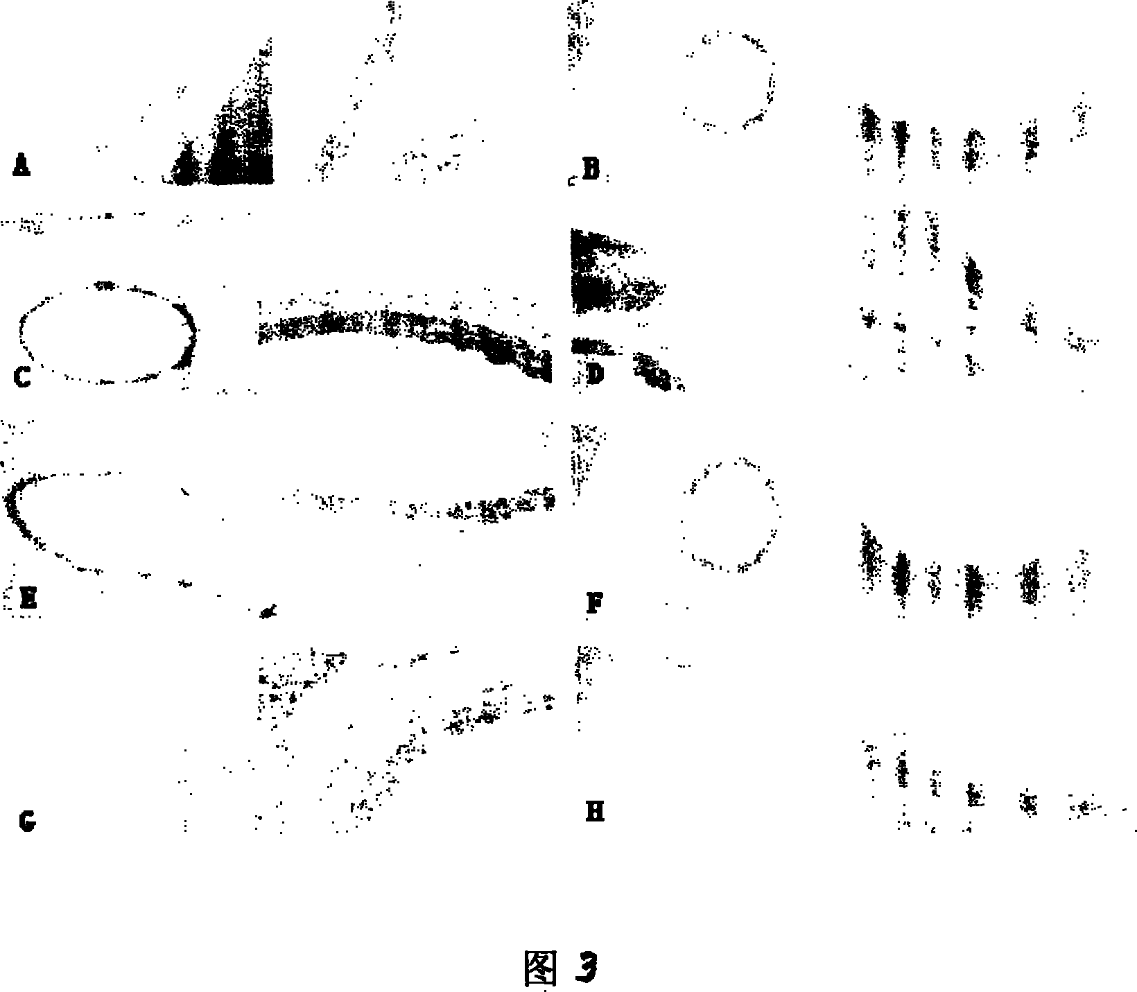 Application of carbenoxolone in preparation of medicine for treating cerebral vasospasm