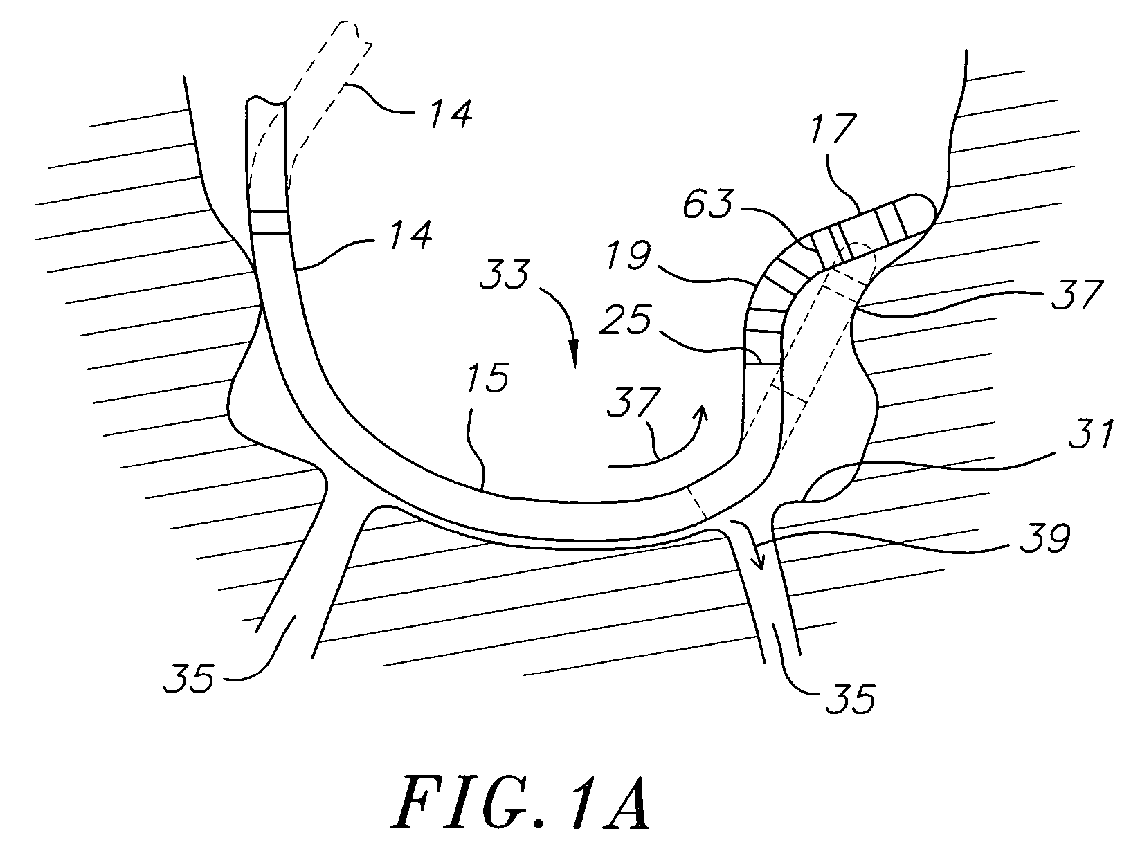 Catheter with flexible pre-shaped tip section