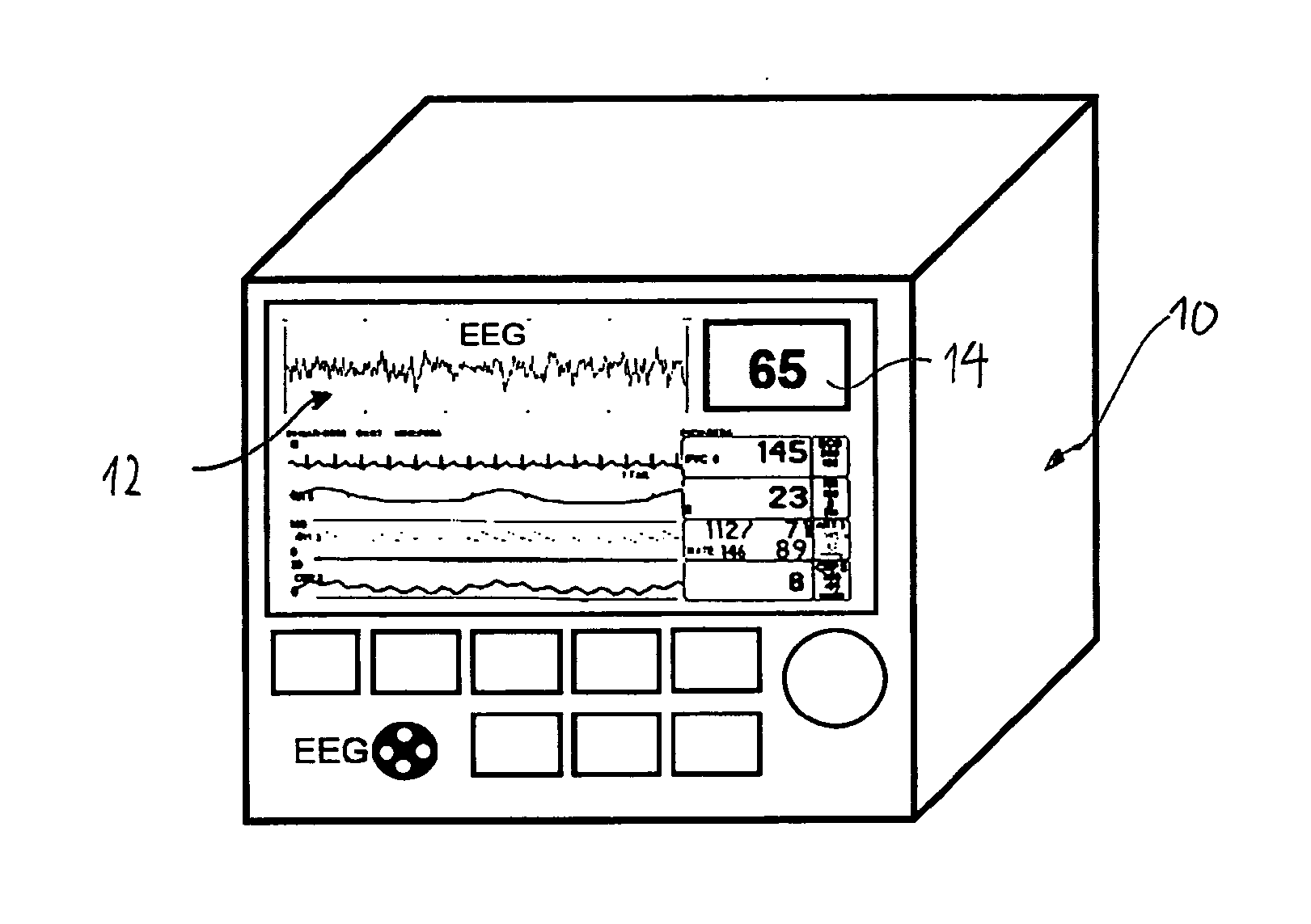 Method and system for quantifying anaesthesia or a state of vigilance