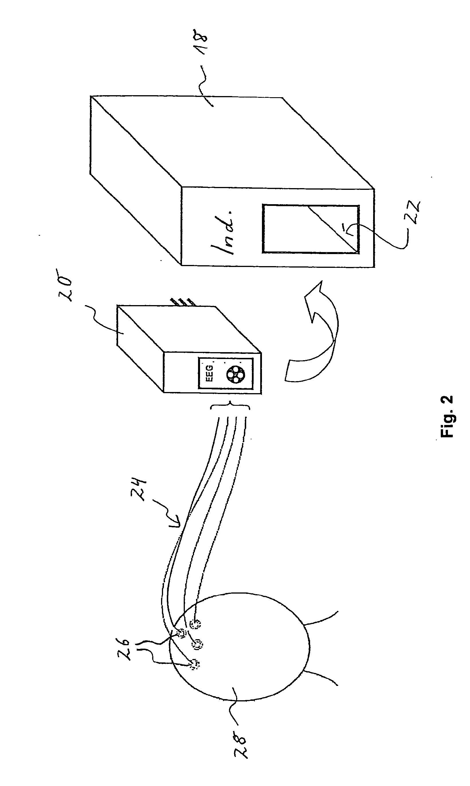 Method and system for quantifying anaesthesia or a state of vigilance