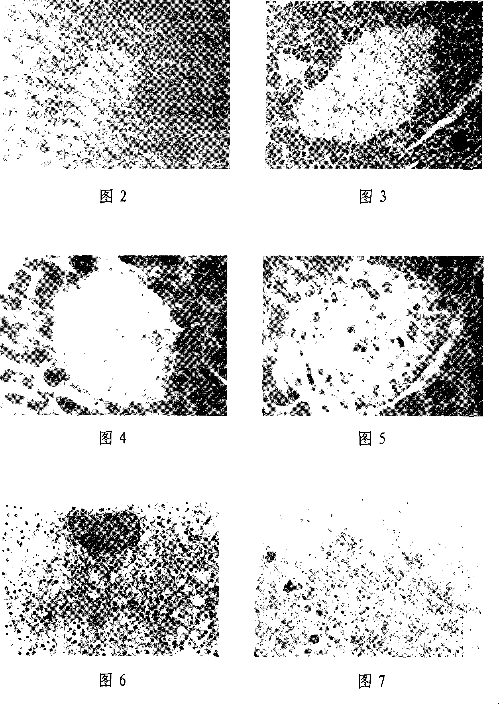 Method for preparing 2 type diabetes rat model