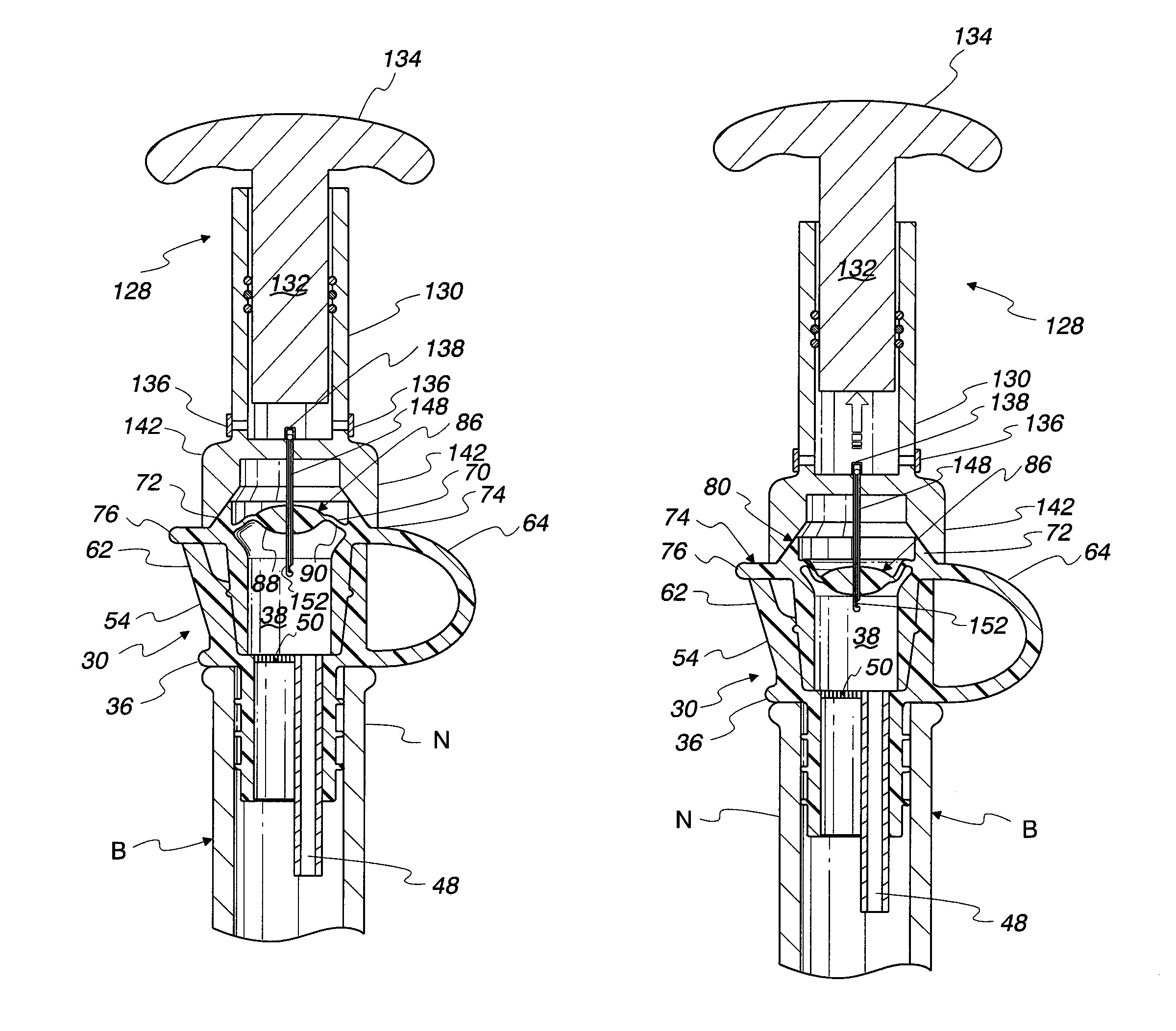 Vacuum bottle stopper for wine and method