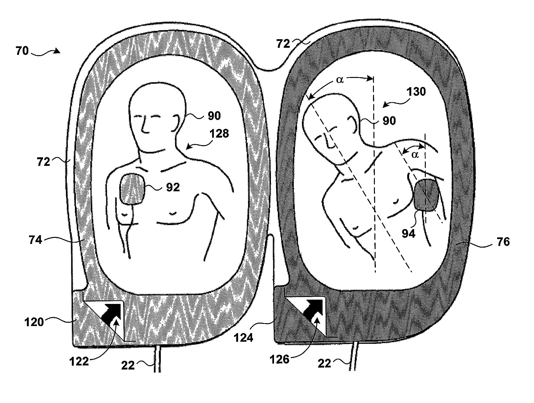 Easy-to-use electrode and package