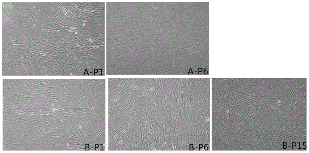 Adipose derived stem cell large-scale culture method