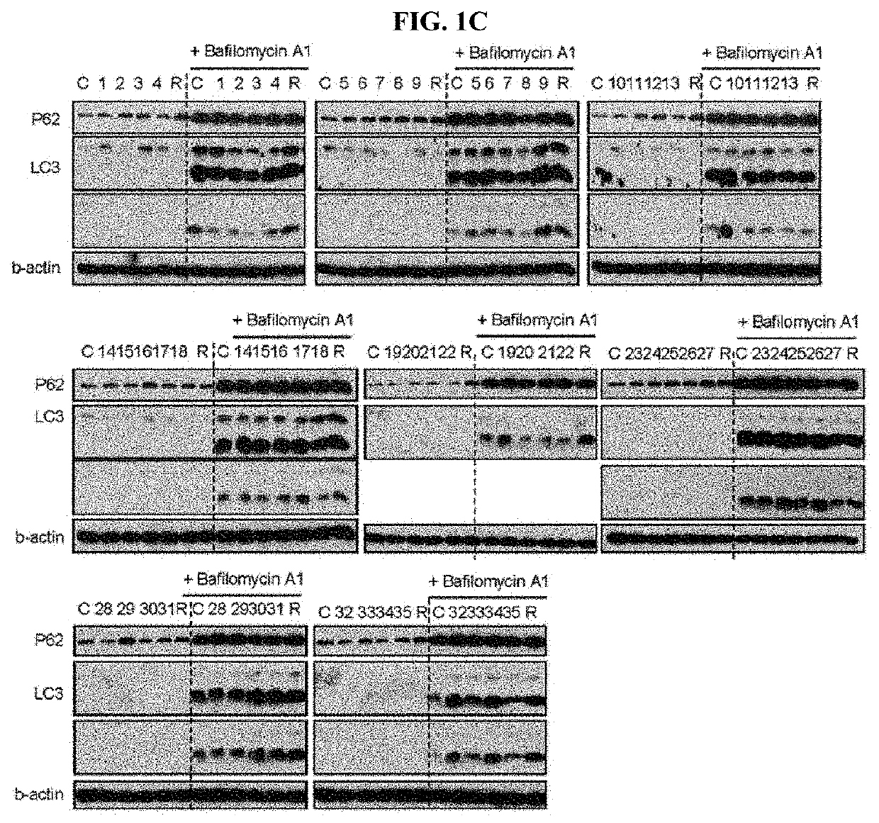 Autophagy enhancer and use thereof