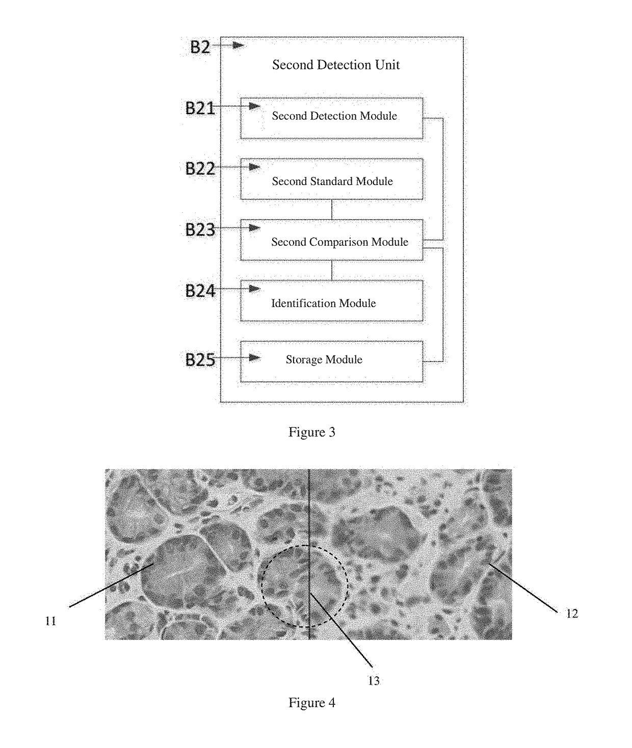 Digital pathological section scanning system