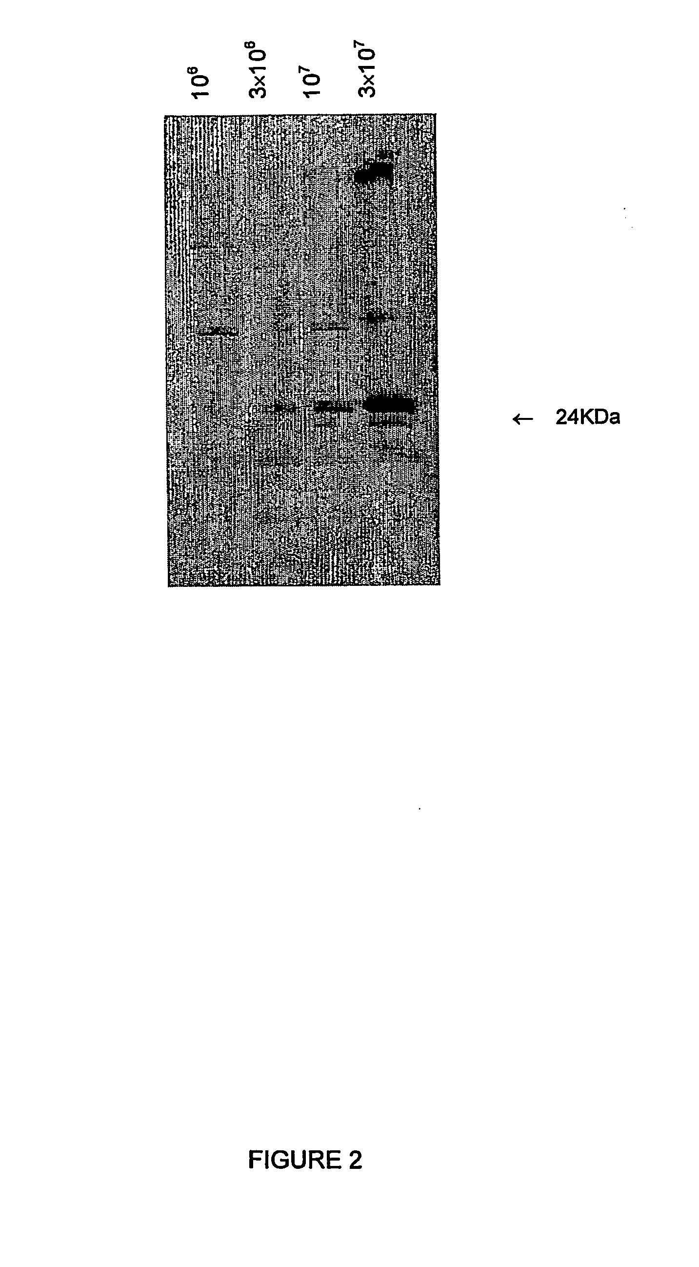 Antibody to latent membrane proteins and uses thereof