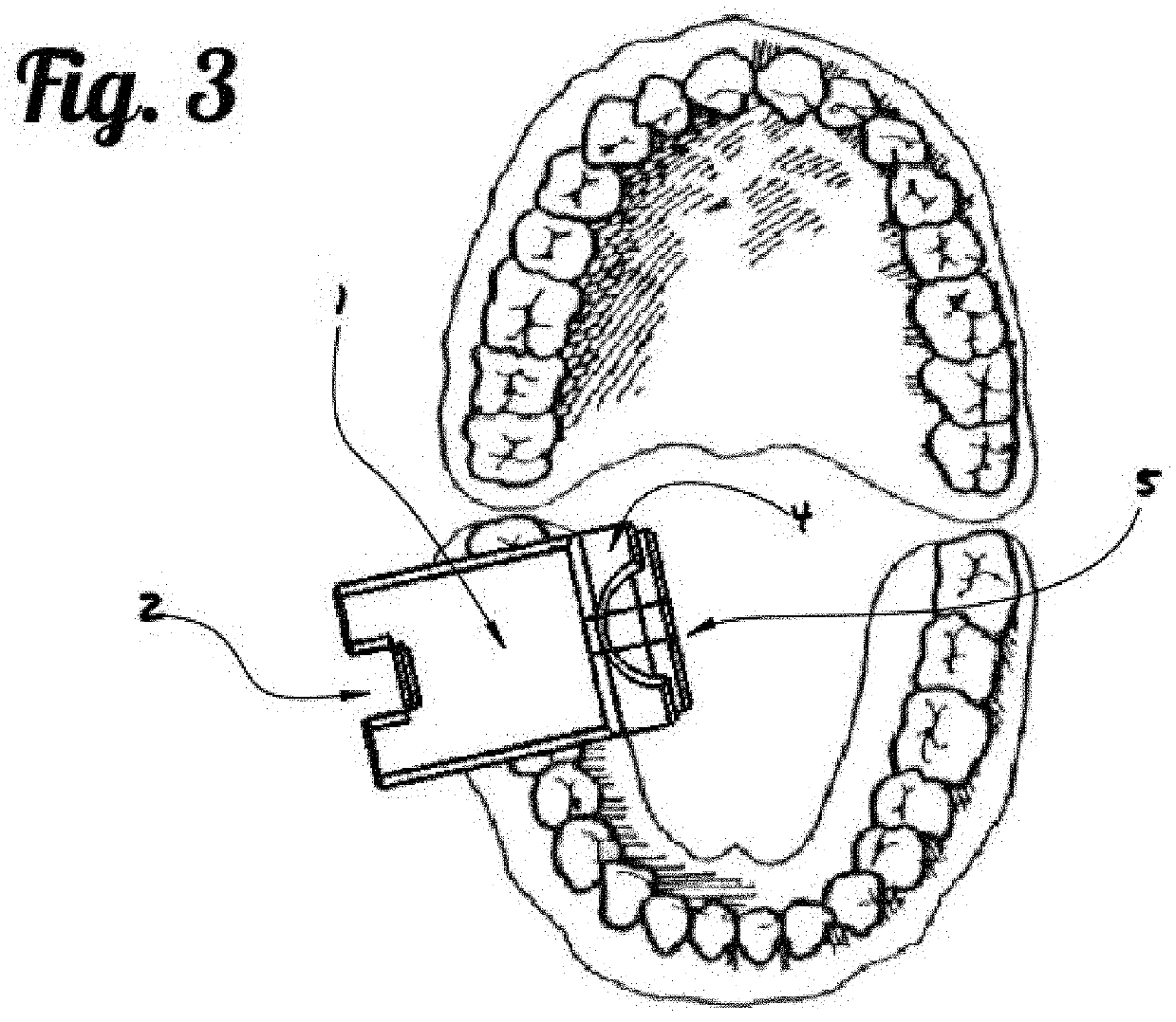 Photoplethysmography Imaging (PPGI)-Based Pulp Vitality Test