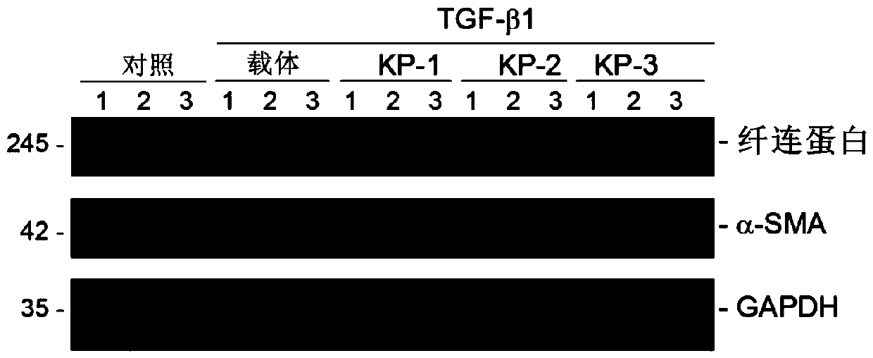 Application of micro-molecule polypeptide KP-1 in preparing medicine for treating chronic kidney diseases