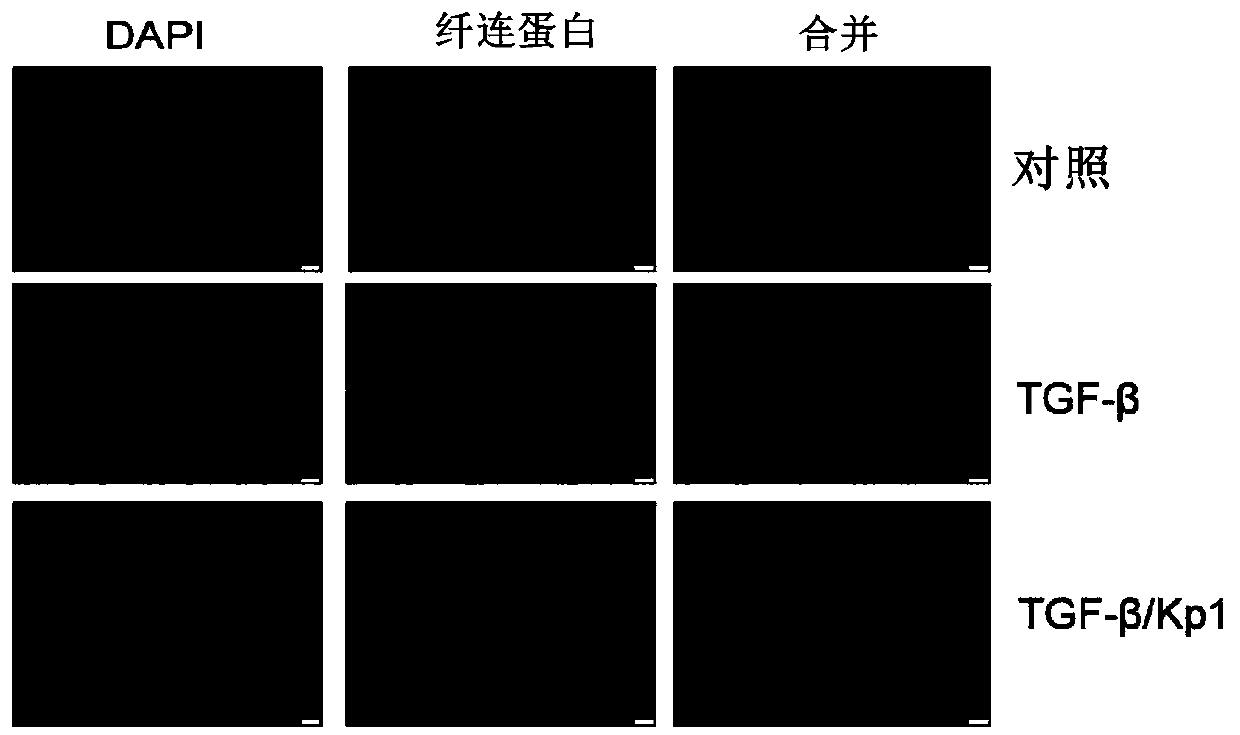 Application of micro-molecule polypeptide KP-1 in preparing medicine for treating chronic kidney diseases