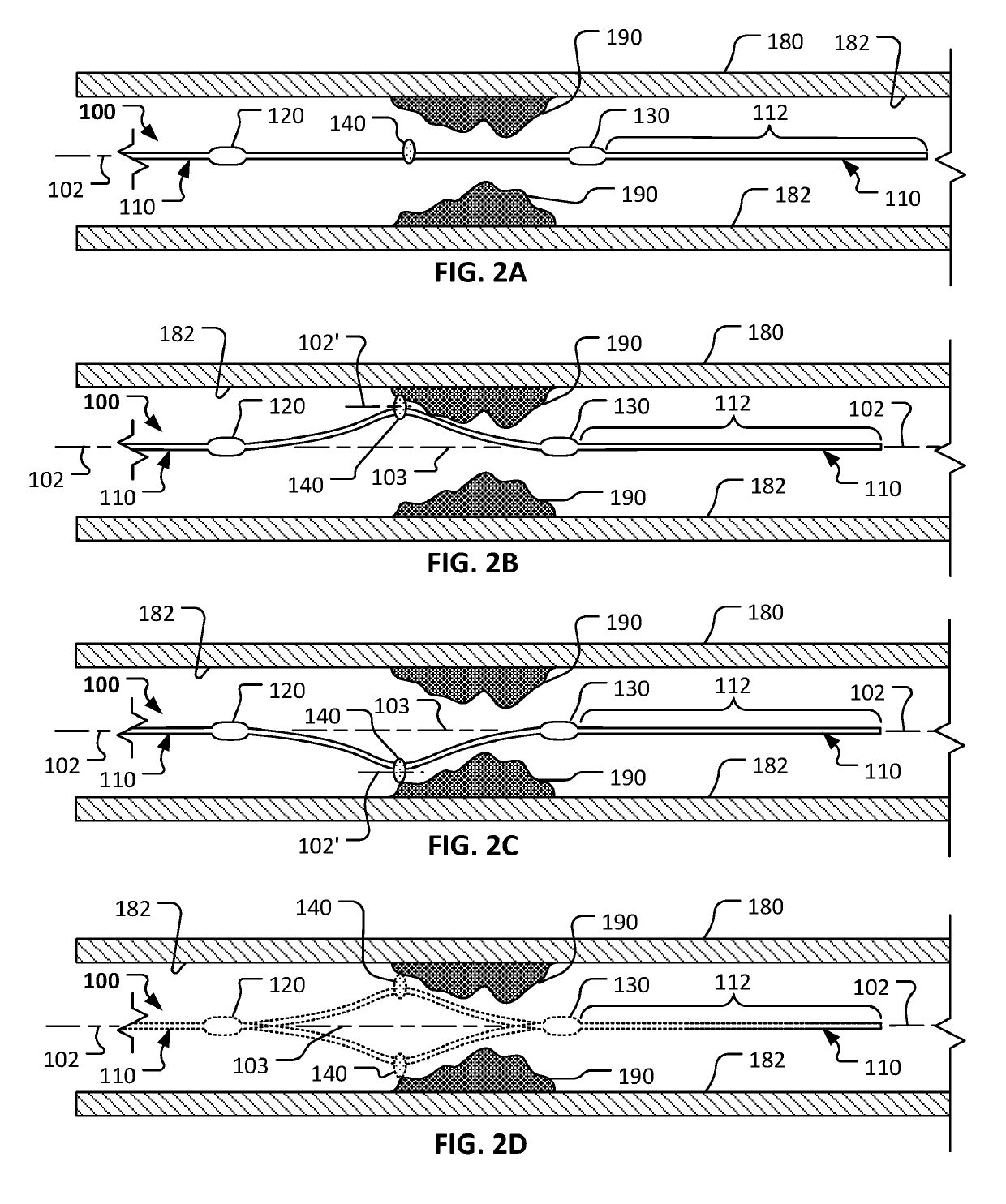 Atherectomy devices and methods