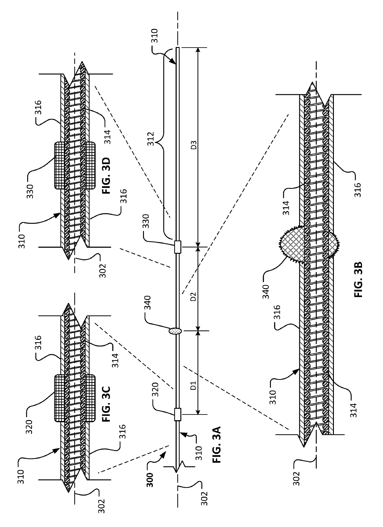 Atherectomy devices and methods