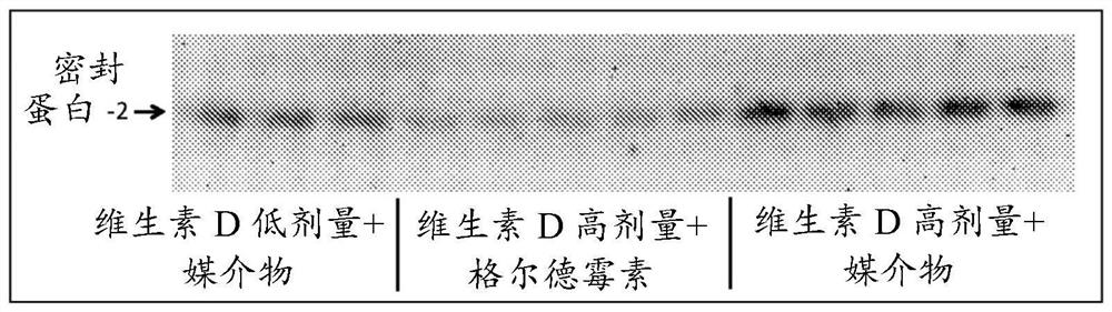 A composition for use in the treatment of conditions caused by calcium deficiency