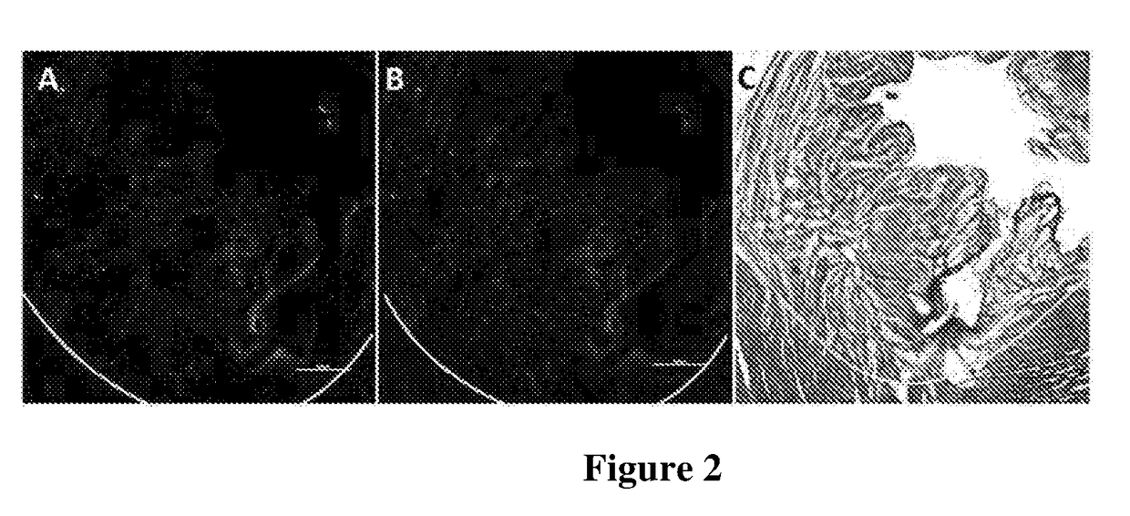 Methods of tissue repair and regeneration