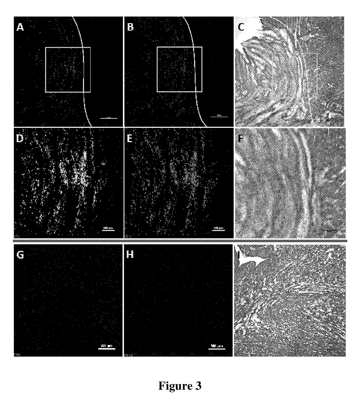 Methods of tissue repair and regeneration