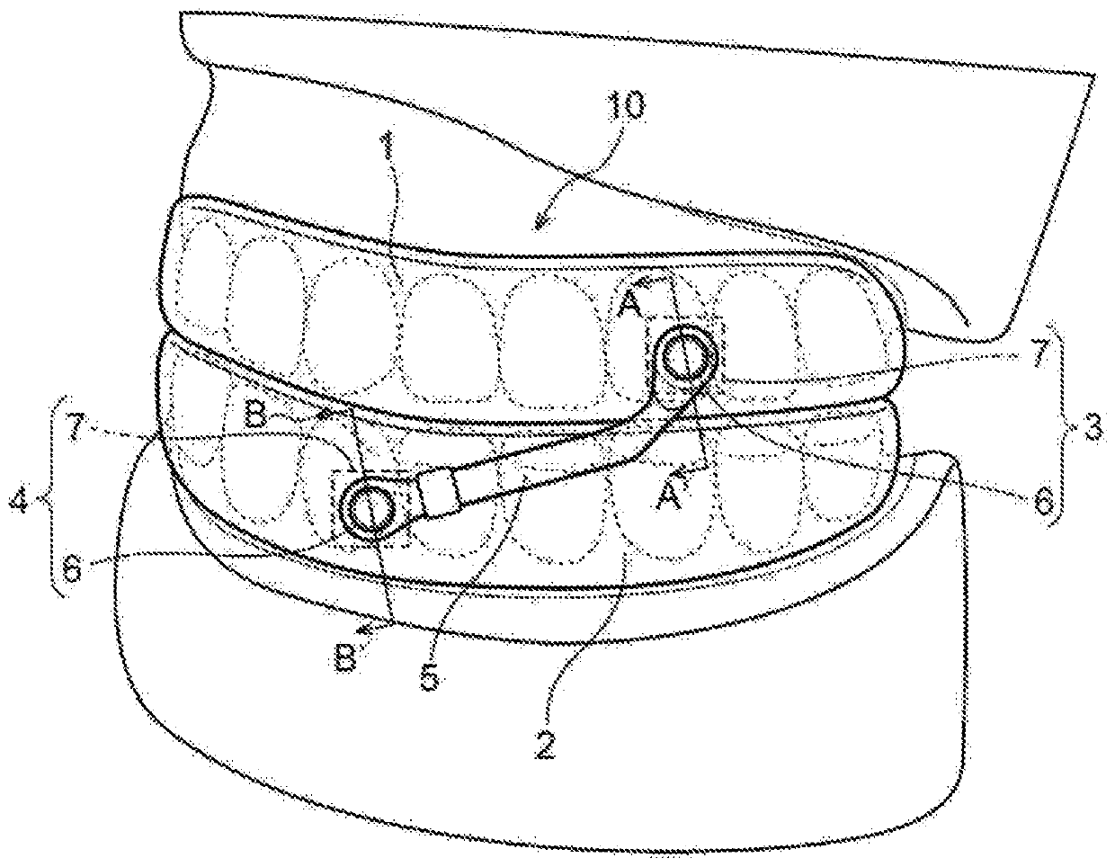 Mouthpiece