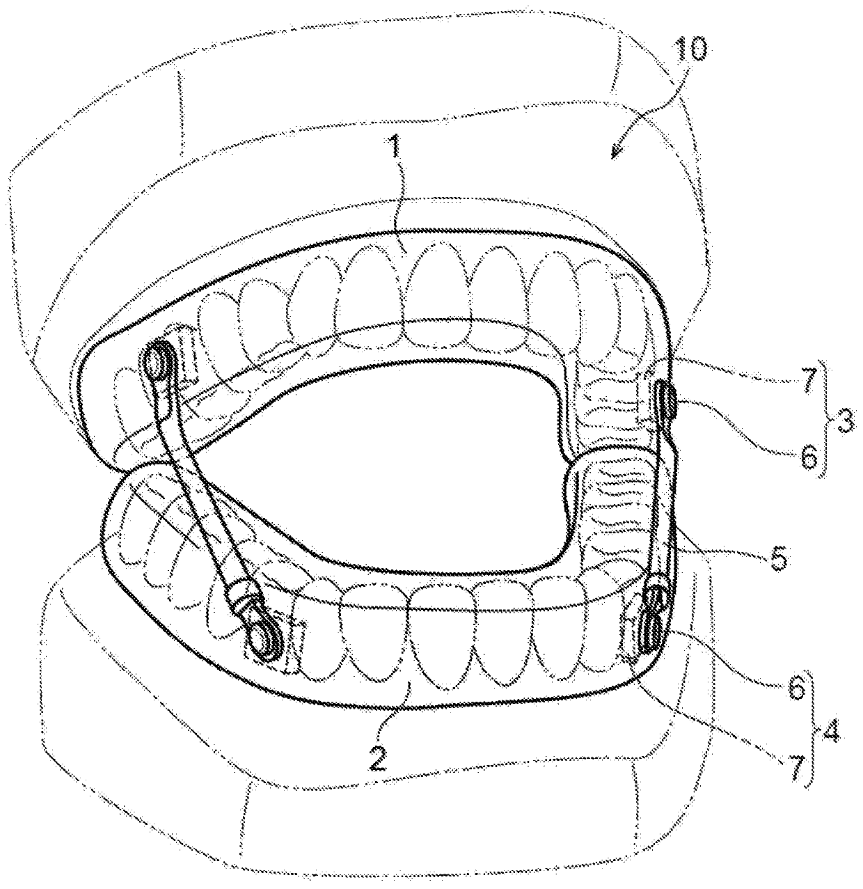 Mouthpiece