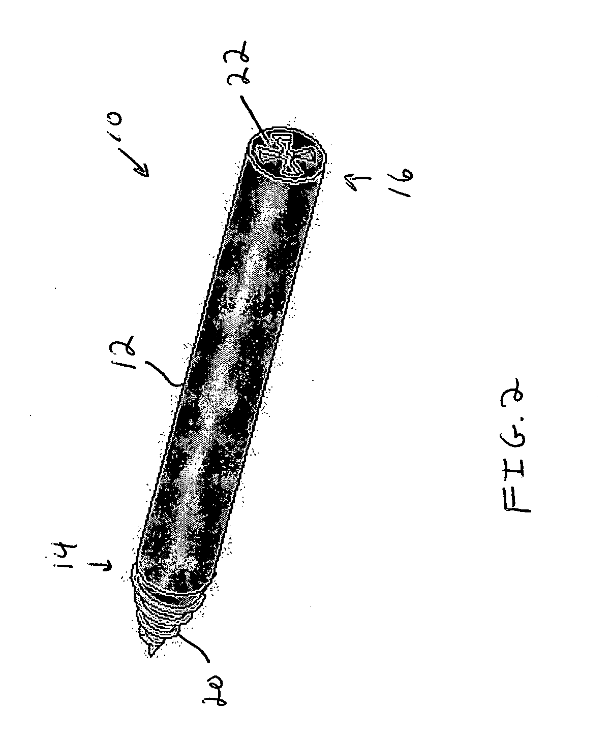 Brachytherapy method and applicator for treatment of metastatic lesions in a load bearing region