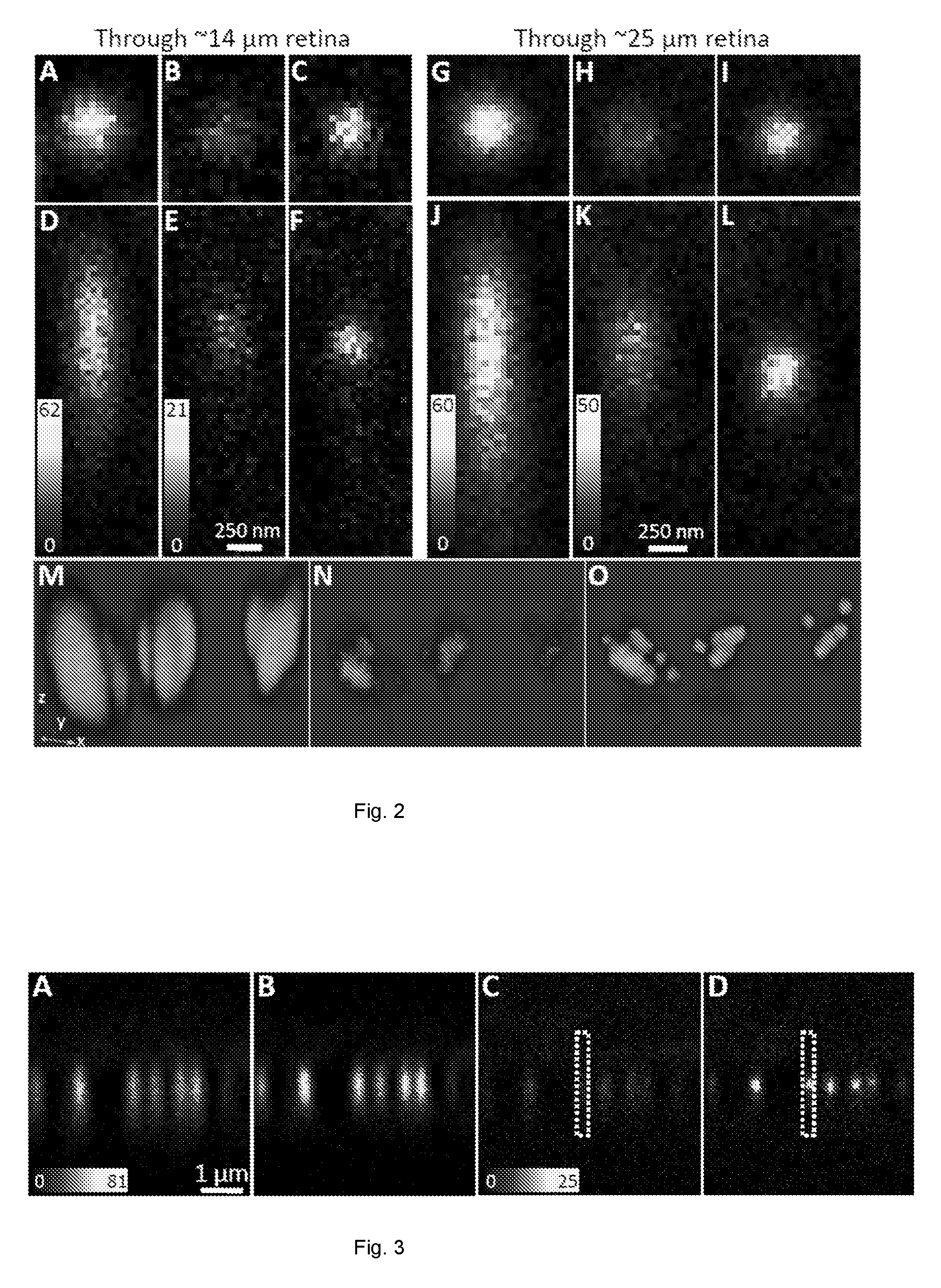 Stimulated emission depletion microscopy