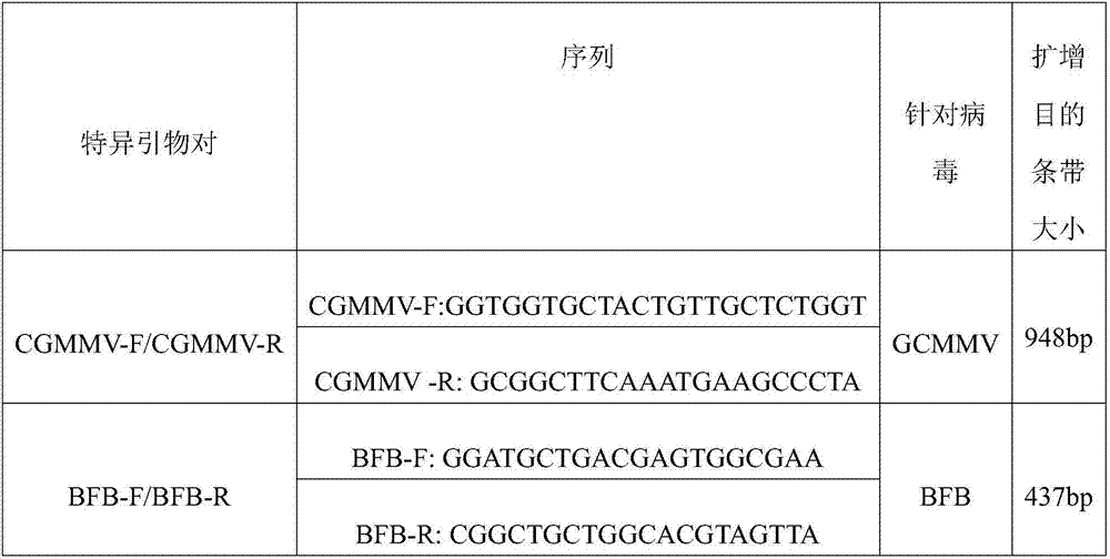 Method capable of synchronously detecting RT-PCR detection primer group of two melon quarantine diseases, kit and application of method