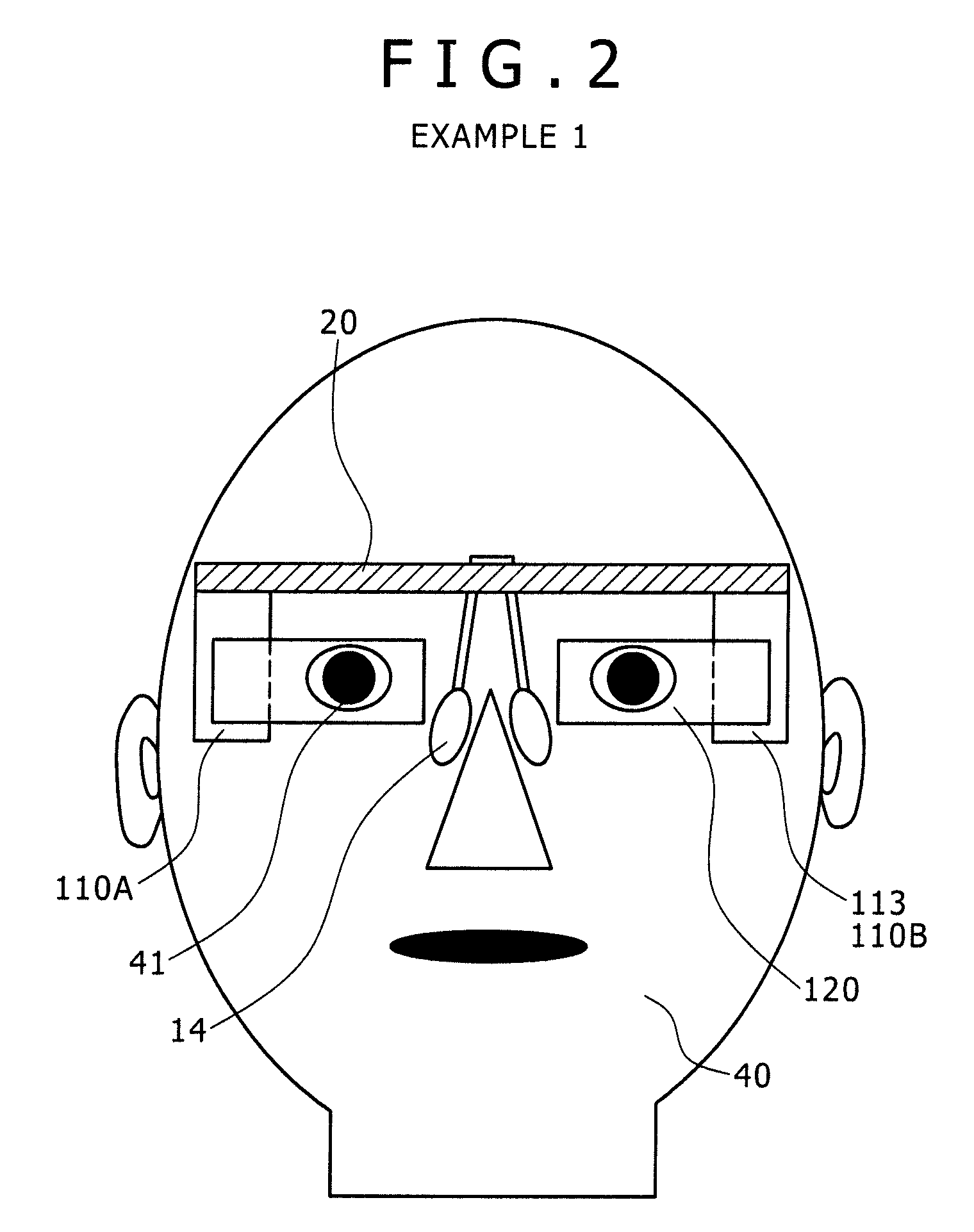 Head mounted display