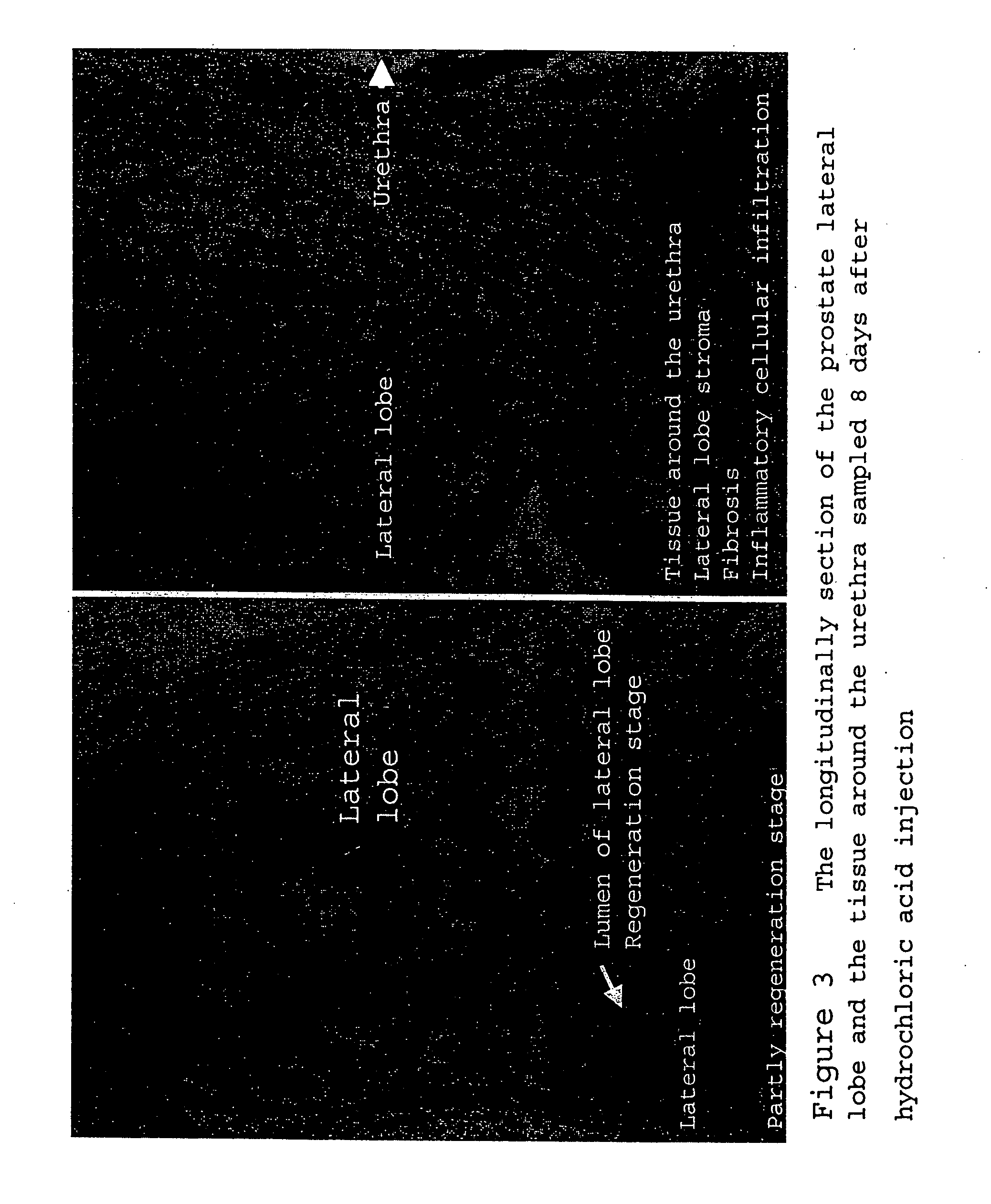 Nonbacterial prostatitis model animal