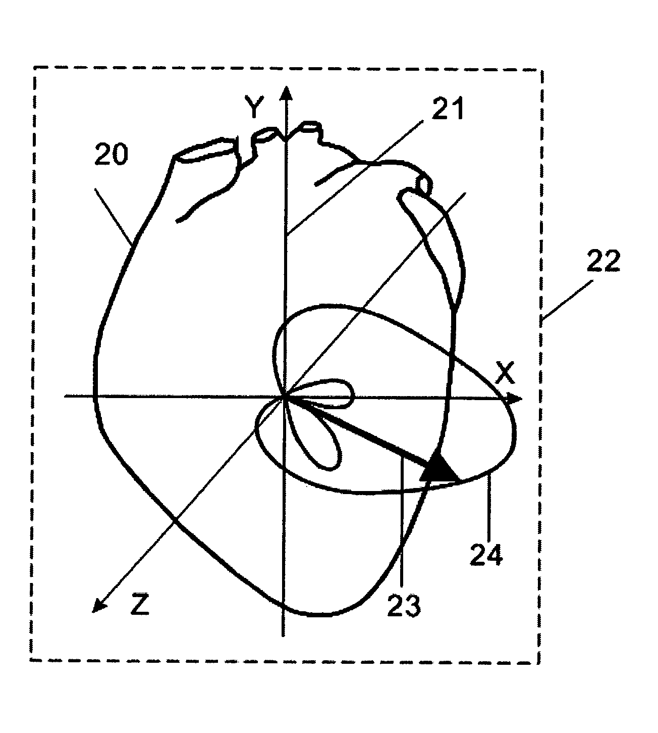 Device and procedure for visual three-dimensional presentation of ECG data