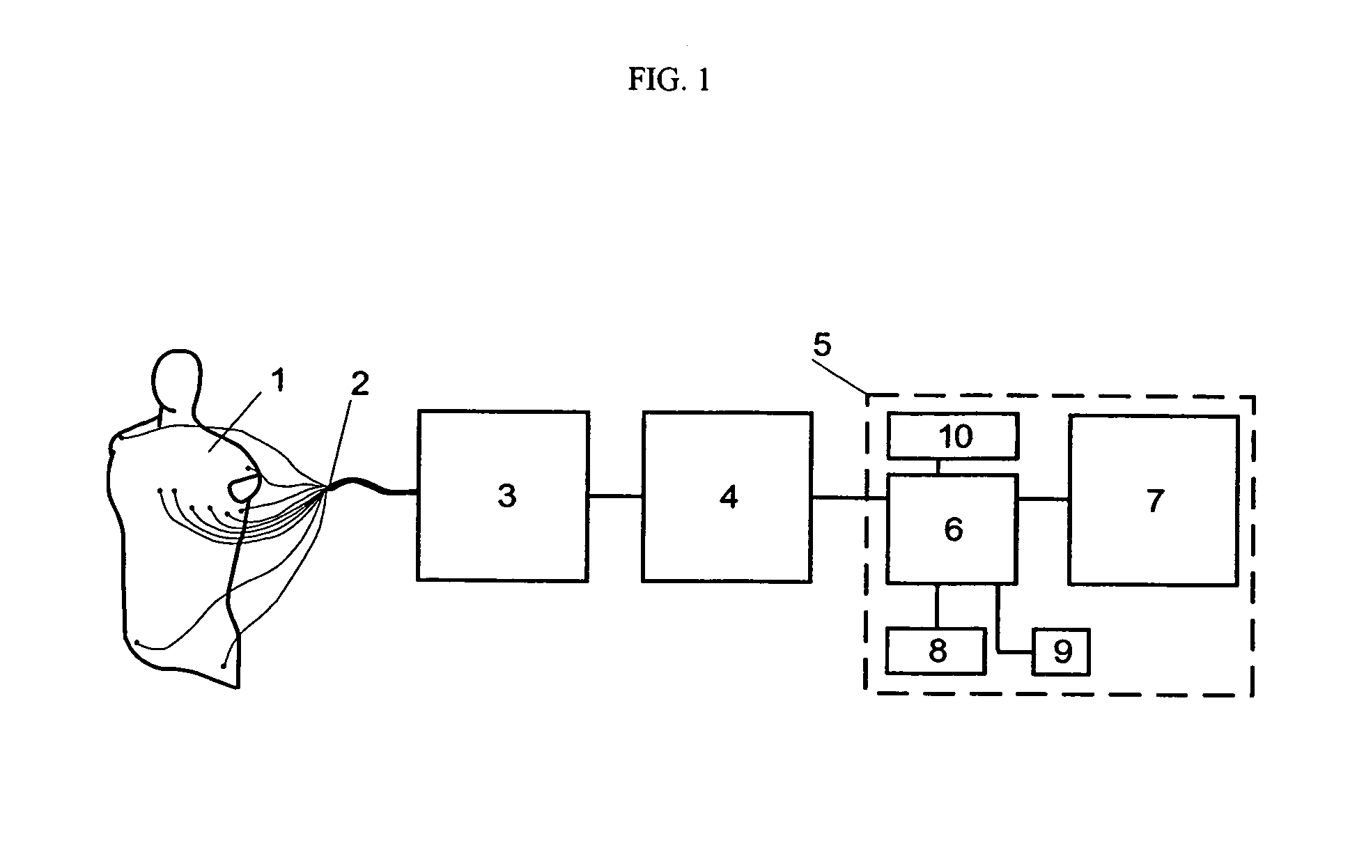 Device and procedure for visual three-dimensional presentation of ECG data